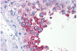 anti-ADP-Ribosyltransferase 3 (ART3) (AA 29-139) antibody