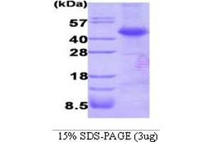 SDS-PAGE (SDS) image for Dystrobrevin Binding Protein 1 (DTNBP1) (AA 1-270) protein (His tag) (ABIN667731) (DTNBP1 Protein (AA 1-270) (His tag))