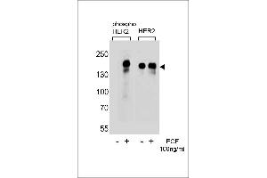 Western blot analysis of extracts from A431 cells,untreated or treated with EGF,100 ng/mL,using phospho HER2- (left) or HER2 Antibody (right) (ErbB2/Her2 anticorps  (pTyr1112))
