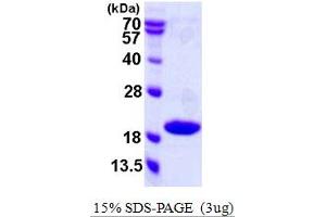 SDS-PAGE (SDS) image for Cyclin-Dependent Kinase Inhibitor 2C (p18, Inhibits CDK4) (CDKN2C) (AA 1-168) protein (His tag) (ABIN667655)