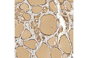 IHC analysis of Citrin/SLC25A13 using anti-Citrin/SLC25A13 antibody (ABIN7599512). (slc25a13 anticorps  (AA 1-643))