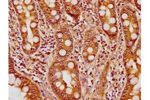 IHC image of ABIN7170949 diluted at 1:200 and staining in paraffin-embedded human small intestine tissue performed on a Leica BondTM system.
