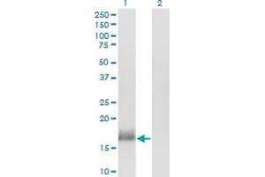 anti-Calmodulin Like Protein 3 (CALML3) (AA 1-150) antibody