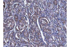 IHC analysis of LIN41/TRIM71 using anti-LIN41/TRIM71 antibody (ABIN7602565).