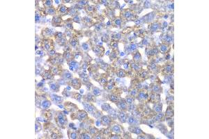 Immunohistochemistry of paraffin-embedded mouse liver using CCBL1 antibody (ABIN5973926) at dilution of 1/100 (40x lens). (CCBL1 anticorps)