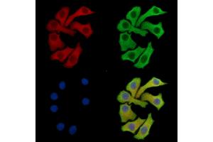 ABIN7096253 and ABIN7100315 staining Hela cells by IF/ICC.