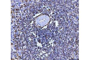 IHC analysis of CD20 using anti-CD20 antibody (ABIN7599180).