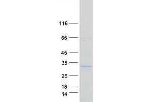 Validation with Western Blot