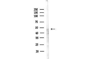 anti-Melanoma Antigen Family A, 11 (MAGEA11) (C-Term) antibody