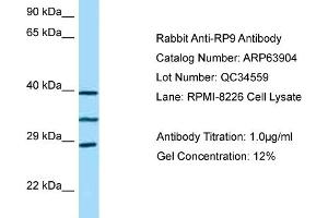 Western Blotting (WB) image for anti-Retinitis Pigmentosa 9 (Autosomal Dominant) (RP9) (C-Term) antibody (ABIN971593) (RP9 anticorps  (C-Term))