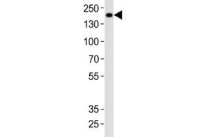 Western blot analysis of lysate from rat brain tissue using Insrr antibody at 1:1000.