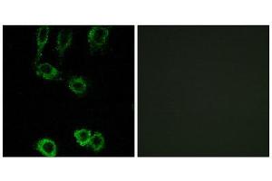 Immunofluorescence (IF) image for anti-Calponin 2 (CNN2) (Internal Region) antibody (ABIN1850970) (CNN2 anticorps  (Internal Region))