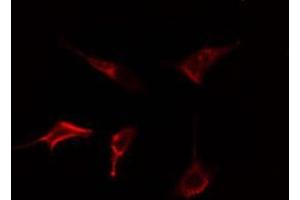 ABIN6278565 staining Hela cells by IF/ICC.