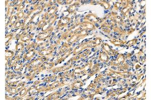 ABIN6263797 and ABIN6278500 at 1/100 staining Mouse kidney tissue by IHC-P. (OCRL anticorps  (C-Term))