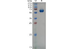 Mouse CS1 Protein, hFc Tag on SDS-PAGE under reducing condition.