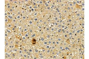 ABIN7093991 and ABIN7098035 at 1/100 staining mouse liver tissue by IHC-P.