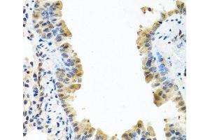 Immunohistochemistry of paraffin-embedded Mouse lung using ARSF Polyclonal Antibody at dilution of 1:100 (40x lens). (ARSF anticorps)