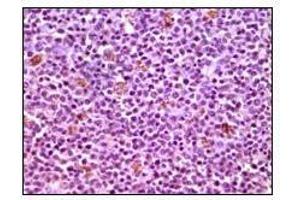 Immunohistochemical analysis of paraffin-embedded human lymphnode tissues using MCL1 antibody with DAB staining.