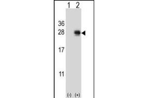 Western blot analysis of CH (arrow) using rabbit polyclonal CH Antibody (Center) (ABIN651719 and ABIN2840373).