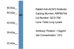 Western Blotting (WB) image for anti-Acyl-CoA Synthetase Family Member 2 (ACSF2) (C-Term) antibody (ABIN2788584)