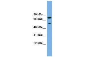 RBM42 antibody used at 1 ug/ml to detect target protein. (RBM42 anticorps  (Middle Region))