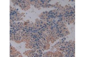 Used in DAB staining on fromalin fixed paraffin- embedded testis tissue (IL-4 anticorps  (AA 21-140))