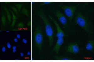 ABIN185521 Immunofluorescence analysis of paraformaldehyde fixed HeLa cells, permeabilized with 0. (Patched 1 anticorps  (C-Term))