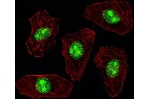 Fluorescent image of A549 cell stained with NPM1 antibody. (NPM1 anticorps  (AA 7-33))