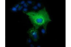 Immunofluorescence (IF) image for anti-L1 Cell Adhesion Molecule (L1CAM) antibody (ABIN1499087) (L1CAM anticorps)