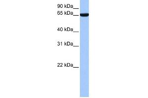 WB Suggested Anti-hCG_1646157 Antibody Titration:  0. (Zinc Finger Protein 891 (ZNF891) (N-Term) anticorps)