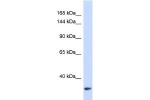 Western Blotting (WB) image for anti-MDM2 Binding Protein (MTBP) (Middle Region) antibody (ABIN2446252) (MTBP anticorps  (Middle Region))