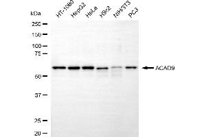 Western blotting analysis using ACAD9 antibody (ABIN7797495).