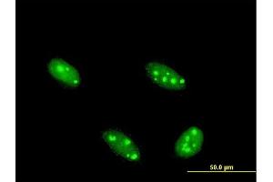 Immunofluorescence of monoclonal antibody to NFIA on HeLa cell. (NFIA anticorps  (AA 1-498))