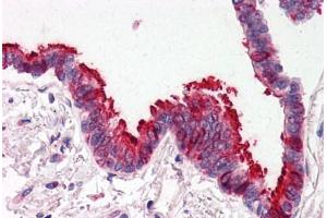 Human Lung, Respiratory Epithelium (formalin-fixed, paraffin-embedded) stained with SKIL antibody ABIN214478 at 2. (SKIL anticorps  (N-Term))