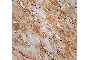 LC3B antibody immunohistochemistry analysis in formalin fixed and paraffin embedded human skeletal muscle.