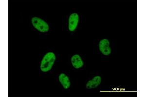 Immunofluorescence of purified MaxPab antibody to CPSF2 on HeLa cell. (CPSF2 anticorps  (AA 1-782))