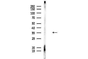 anti-Dehydrogenase/reductase (SDR Family) Member 4 (DHRS4) (C-Term) antibody