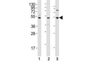 Western blot testing of LAG3 antibody at 1:2000 dilution tested on human lysates, Lane 1: K562; 2: liver; 3: ovary; Predicted molecular weight ~54 kDa. (LAG3 anticorps  (AA 103-132))