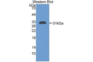 Detection of Recombinant GP39, Rat using Polyclonal Antibody to Chitinase-3-like Protein 1 (CHI3L1) (CHI3L1 anticorps  (AA 117-364))