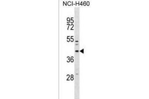 MFF Antibody (Center) (ABIN1537829 and ABIN2838250) western blot analysis in NCI- cell line lysates (35 μg/lane).