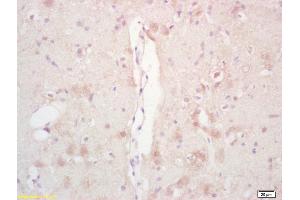Formalin-fixed and paraffin embedded rat brain labeled with Rabbit Anti Phospho-Acetyl CoA Carboxylase(Ser79) /ACACA Polyclonal Antibody, Unconjugated (ABIN1386220) at 1:200 followed by conjugation to the secondary antibody and DAB staining