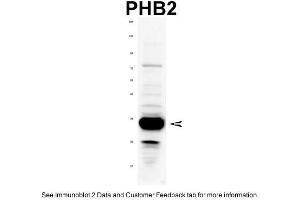 WB Suggested Anti-PHB2 Antibody Titration: 1 ug/mlPositive Control: Rat tissue (Prohibitin 2 anticorps  (C-Term))