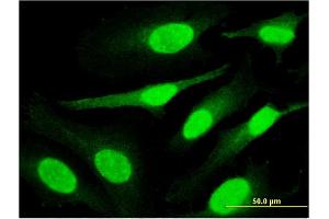 Immunofluorescence of monoclonal antibody to PPHLN1 on HeLa cell. (PPHLN1 anticorps  (AA 168-258))
