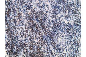 Image no. 1 for anti-Deoxycytidine Kinase (DCK) antibody (ABIN1497773)