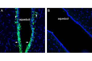 Expression of Cannabinoid Receptor 2 in rat midbrain aqueduct.