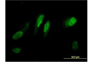 Immunofluorescence of monoclonal antibody to C13orf15 on HeLa cell. (RGC32 anticorps  (AA 1-117))