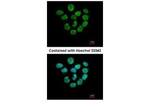 ICC/IF Image Immunofluorescence analysis of paraformaldehyde-fixed A431, using Histone H2A.
