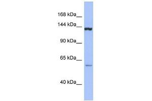 DHX34 antibody used at 1 ug/ml to detect target protein. (DHX34 anticorps)