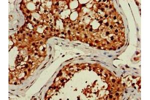 Immunohistochemistry of paraffin-embedded human testis tissue using ABIN7158320 at dilution of 1:100 (LHFPL5 anticorps  (AA 46-99))