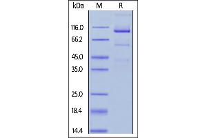 Fed Human Glypican 3, Fc Tag on  under reducing (R) condition.